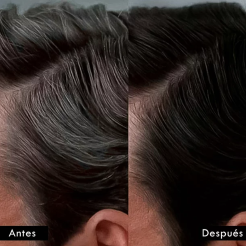 Kit de la JUVENTUD - Tónico crecimiento capilar y Champú Cubre Canas